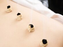 満月堂/温まるお灸