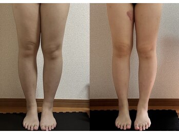 リノリー 古川店(rinory)/瞬冷スリムボディケア♪