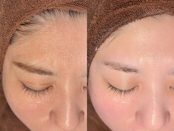 ルーナジェーナ(Luna llena)/池袋　エステ　ルーナジェーナ