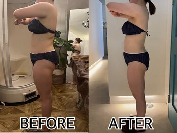 インプルーブ エステティック(Improve ESTHETIC)/〈1年通っているお客様〉