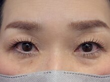 エイジレス(AGELESS)/ポイント→瞼に当たらない奥行き