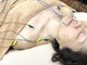 ビースタイル(B-style)の写真/【猫背/巻き肩/首肩こり/くいしばり】電気美容鍼×電気肩こり鍼で悩み解消!貴方に向き合う施術と熟練技が◎