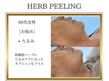 ロージー(ROSY)/ハーブピーリング/阿南/徳島