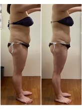 ニコワ(Nicowa)/Nicowaの痩身★BeforeAfter