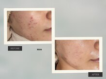 ブルーエム 大森(Blue－M)/