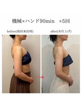 ビノワ(Binowa)/継続は力なり！