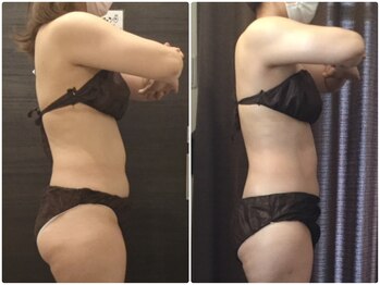 美容整体ウェリナ 名駅院/小顔矯正/骨盤矯正/美脚サロン