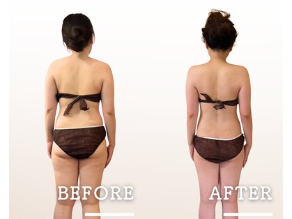 トレボ 福岡天神(TREVO)の写真