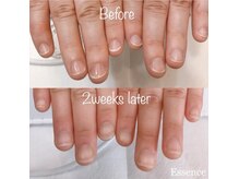 エッセンス (Essence)の雰囲気（深爪,むしり癖など改善し、美爪へ導く施術をあなたにも。）