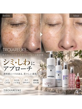 ザ ギフト 栄(The Gift)の写真/未来の肌に差がつく★トロイアルケの最新肌管理で年齢サインに集中アプローチ！【平日限定◇6,900円~】