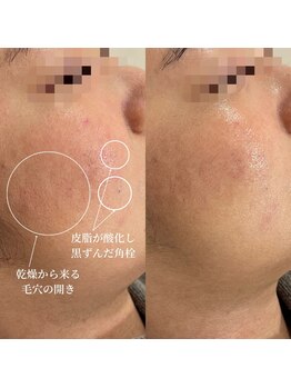 ラ クレール ビューティーサロン(LA CLAIR)/アンストレス