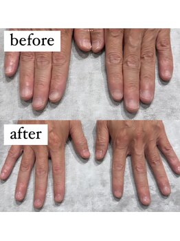 メンズクリアネイル