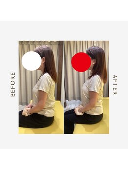 多摩 唐木田整体室/猫背・首コリ/ビフォーアフター