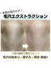 毛穴エクストラクション×肌質改善トリートメント¥11,000→【初回限定】¥5500