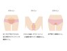 【VIOアンダーヘア脱毛】自己処理が難しい箇所はプロにお任せ★