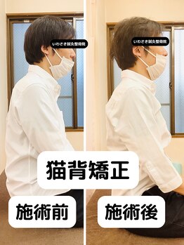 いわさき鍼灸整骨院/猫背矯正　施術効果