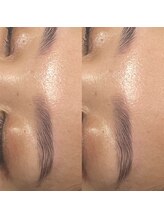 ピピラッシュ(pipi lash)/ブロウリフト