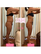 キュール(KuhL)/30代痩身ビフォーアフター☆