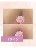 【ローマピンク40%off】初回カウンセリング《iライン》