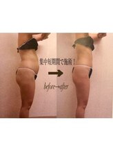 ベルア(Bellelea)/ダイエット痩身　