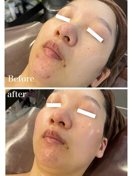 オレアグリーン 岡崎(OLEA green)/