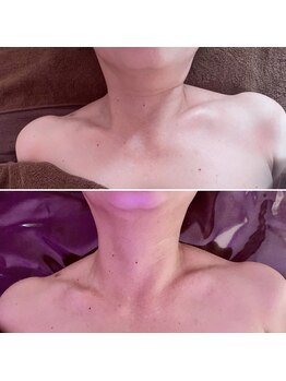 コルッソ(CoLusson.)/背面から緩め筋緊張を取る