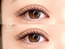 アイリュクス ブルーム(eyeluxe bloom)/