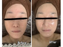 ブランシュール/ヒト幹細胞×エンビロンペプチド