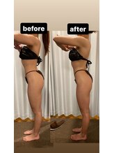 アヌヘア(Anuhea)/インディバ痩身