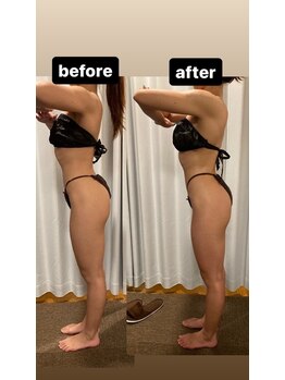 アヌヘア(Anuhea)/インディバ痩身