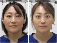 顔と身体の歪み矯正院 吉祥寺の雰囲気（ビフォーアフター）