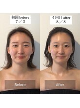 サロンウム(Salon umu)/効果的な頻度は1ヶ月に4回