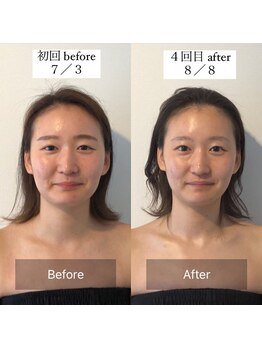 サロンウム(Salon umu)/効果的な頻度は1ヶ月に4回