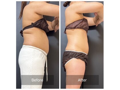 マリー ザ ビューティー(mary the beauty)の写真