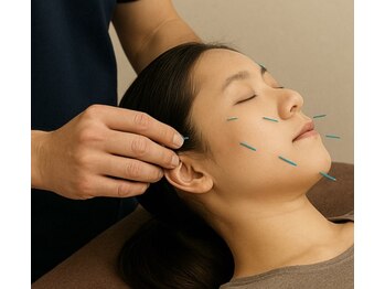 オレンジ接骨院/定額制美容鍼50本コース【5回】