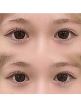 アルーマ アイ(allma.eye)/ぱっちり上下パーマ