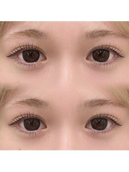 アルーマ アイ(allma.eye)/ぱっちり上下パーマ