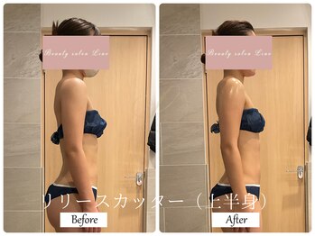 リノ(Lino)/ブライダルエステでご来店♪