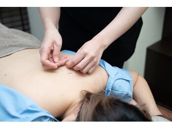 ヴィクトワール 池袋東口の写真/女性専用プライベートサロンで鍼灸施術を。お一人お一人丁寧に心身を整えます