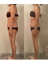 ピカケ(PIKAKE)/筋膜リリース