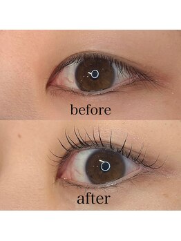 ボアップ 松山店(boappu)/住田限定クーポン