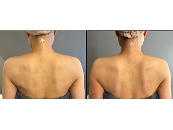 九月屋/首の歪み