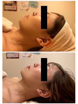 ルナグランデ 心斎橋店(Luna grande.)/圧倒的小顔