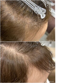 ヒルナム(Heal Nam)/~プロセルセラピーズ~頭皮