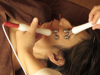 フェルーシュ鍼灸 銀座(Feruche)の写真/【たるみケア・フェイスラインに特化】美容鍼×コルギ×最先端フェイシャルで叶えるフェイスエイジングケア