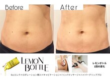 クリニカルエステ イーズ 小倉リバーウォーク北九州デコシティ店/BODYレモンボトル変化写真-6