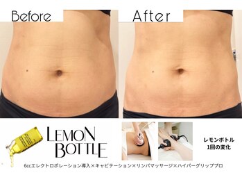クリニカルエステ イーズ 小倉リバーウォーク北九州デコシティ店/BODYレモンボトル変化写真-6