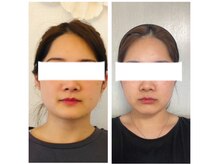 サロン ド ルポゼ(Salon de Reposer)