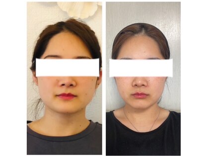 サロン ド ルポゼ(Salon de Reposer)の写真