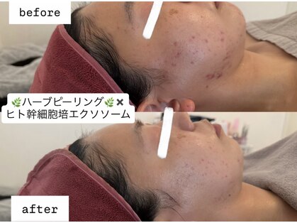 エム シャルール(M chaleur)の写真